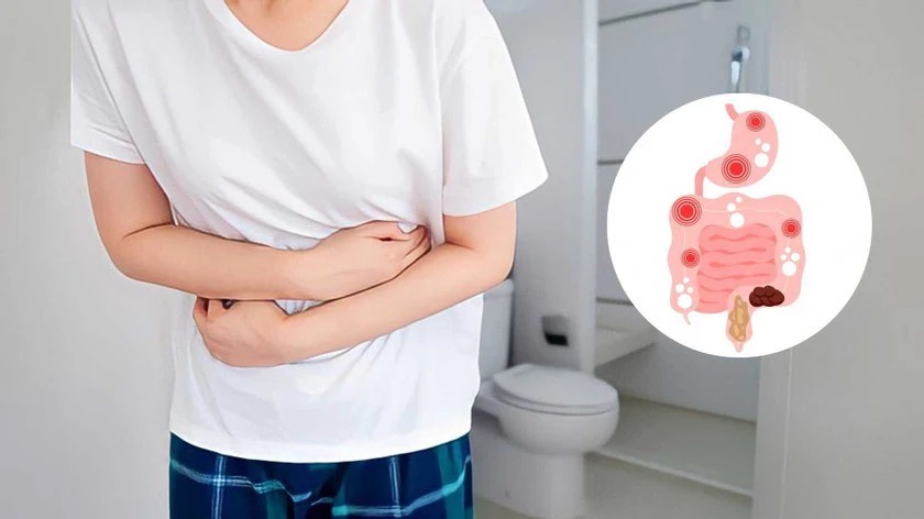 Đi ngoài không hết gây căng tức, khó chịu và mót rặn