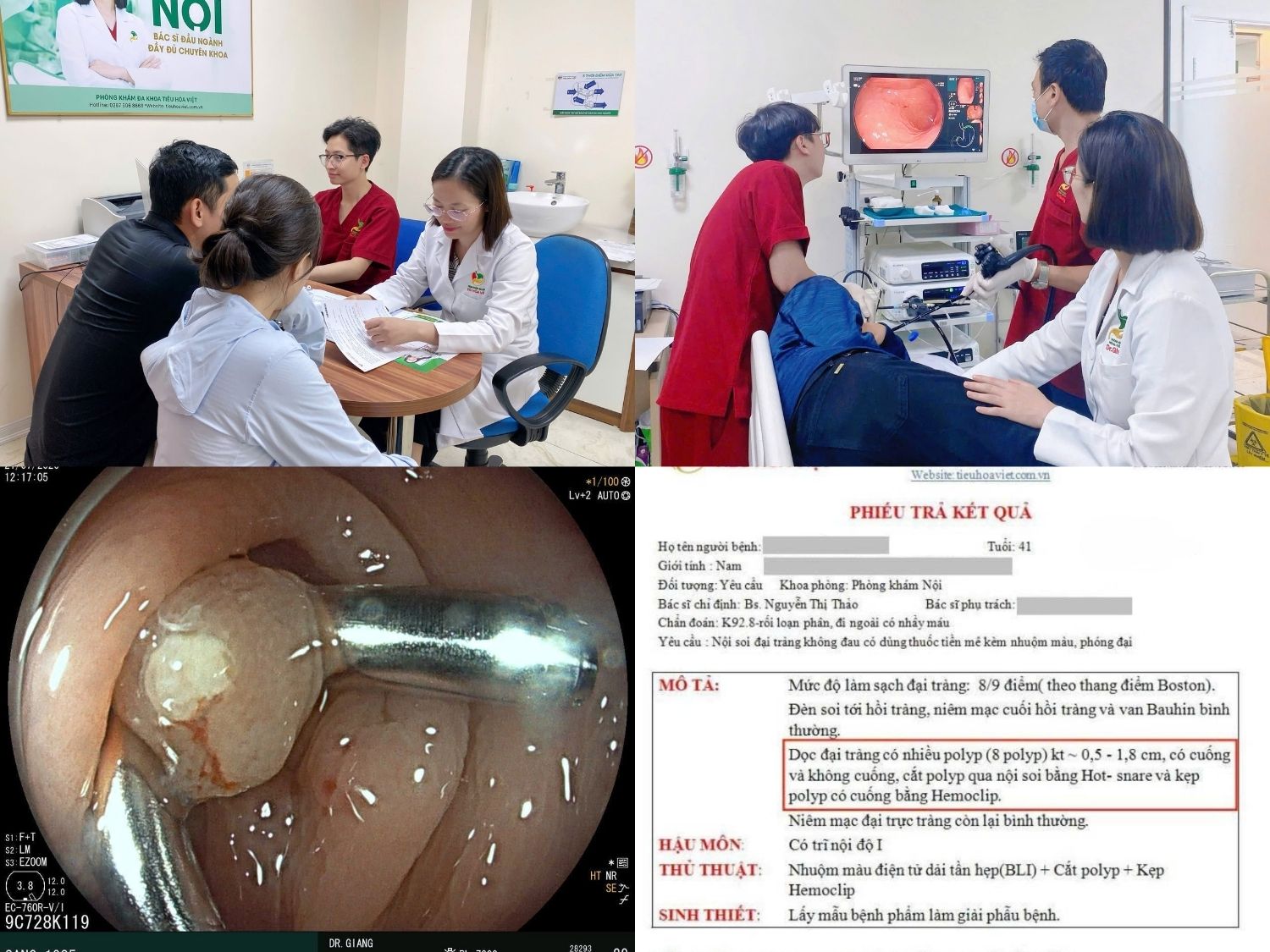 Quy trình xử lý polyp đại tràng gồm thăm khám, nội soi phát hiện tổn thương, can thiệp cắt polyp và gửi mẫu làm giải phẫu bệnh để xác định bản chất mô và định hướng theo dõi sau điều trị.