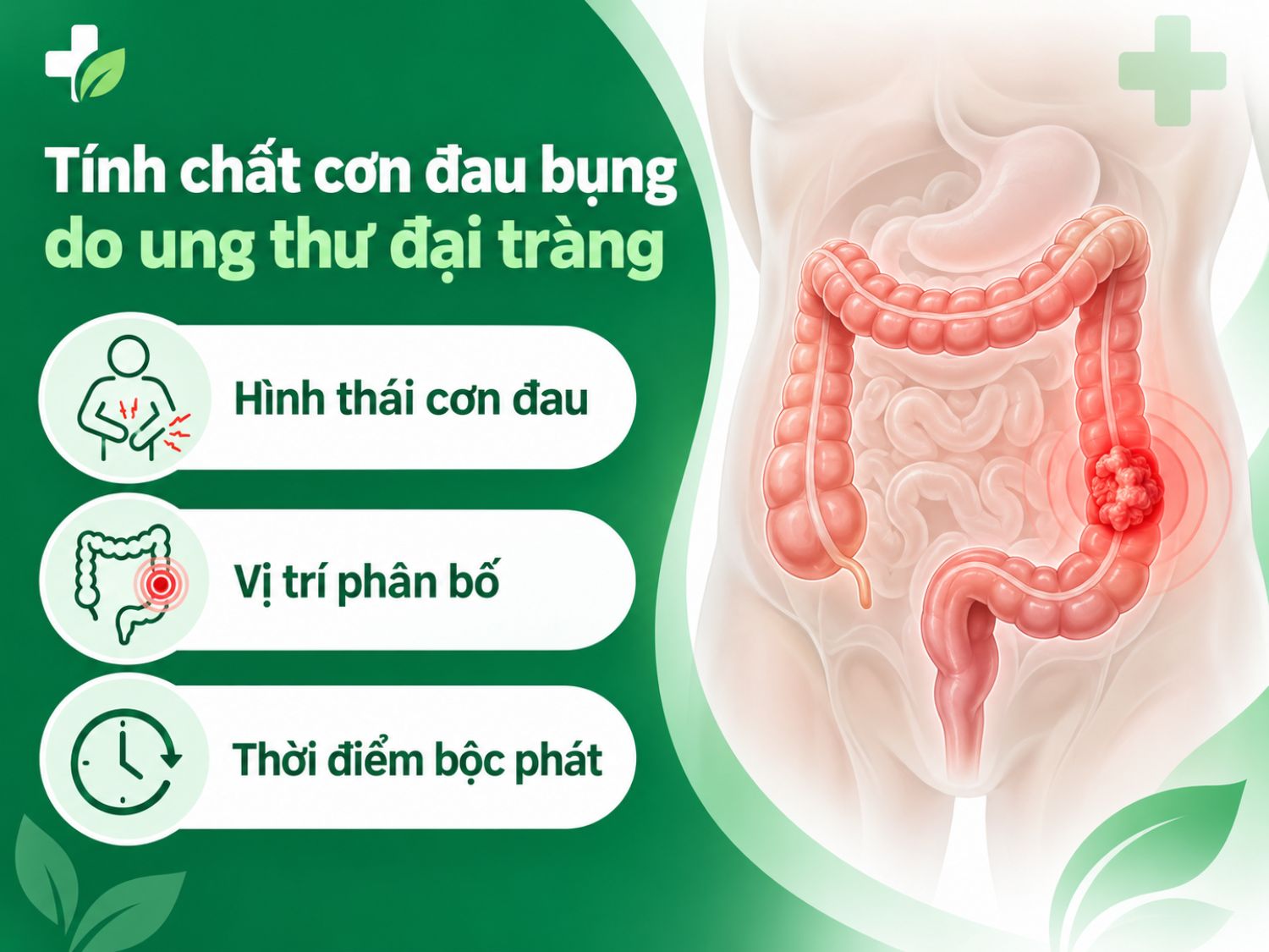 Tóm tắt các đặc điểm thường gặp của cơn đau bụng do ung thư đại tràng: kiểu đau, vị trí đau và thời điểm cơn đau dễ xuất hiện.