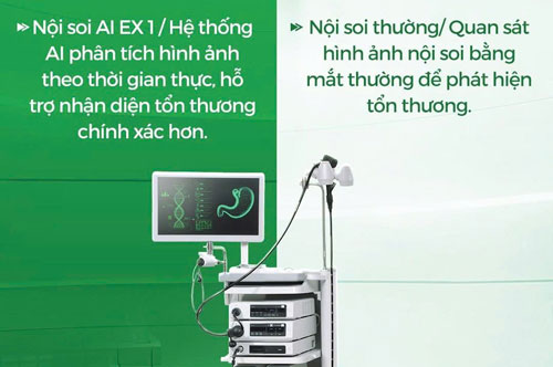 TS.BS Đỗ Anh Giang trực tiếp thực hiện nội soi công nghệ AI EX1