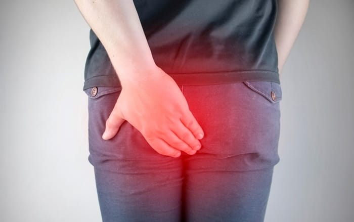 Nứt kẽ mãn tính gây đau khó chịu dùng thuốc không có tác dụng