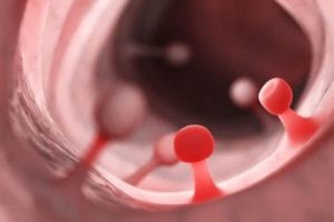 Polyp dạ dày có nguy hiểm không?  TS. BS Đỗ Anh Giang trả lời