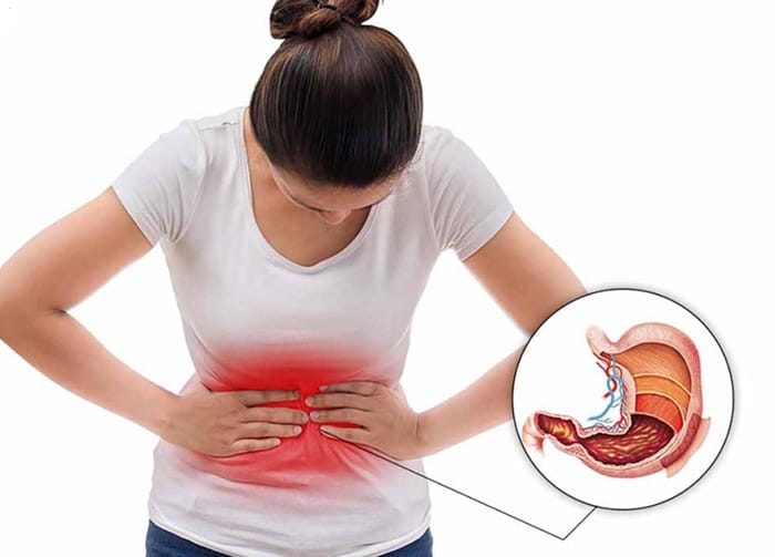 Đau bụng, đau âm ỉ là dấu hiệu polyp dạ dày