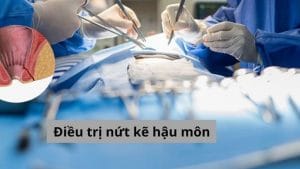 Nứt kẽ hậu môn có chữa được không? Cần chú ý điều gì