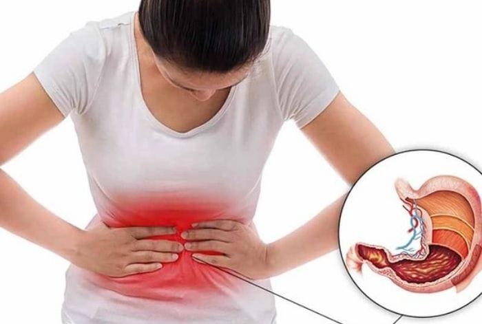 viêm dạ dày cần thăm khám định kỳ