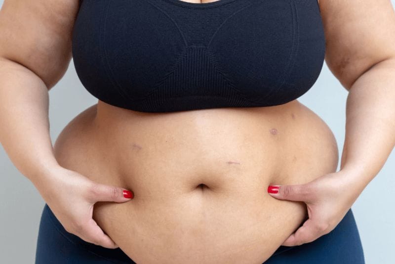 Người béo phì thuộc nhóm nguy cơ cao, cần nội soi dạ dày