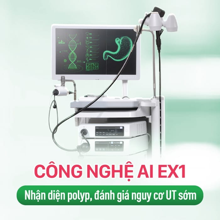 Ưu tiên ứng dụng công nghệ hiện đại thăm khám polyp dạ dày