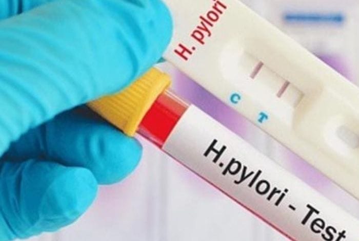 Test HP dạ dày sớm