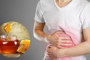 5 Cách chữa trào ngược dạ dày bằng mật ong hiệu quả
