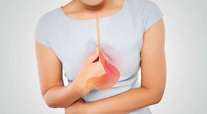Có thể chữa khỏi trào ngược dạ dày khi được phát hiện sớm