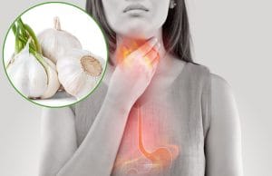 Cách chữa trào ngược dạ dày bằng tỏi