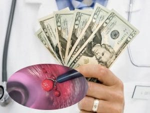 Chi phí cắt polyp hậu môn ? Bảng giá mới nhất