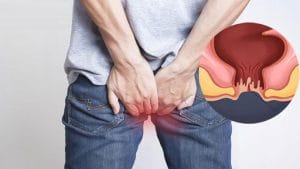 Địa chỉ điều trị nứt kẽ hậu môn: Gợi ý 7 địa chỉ uy tín