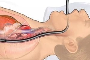 Giá nội soi dạ dày không gây mê là bao nhiêu? Bảng giá mới