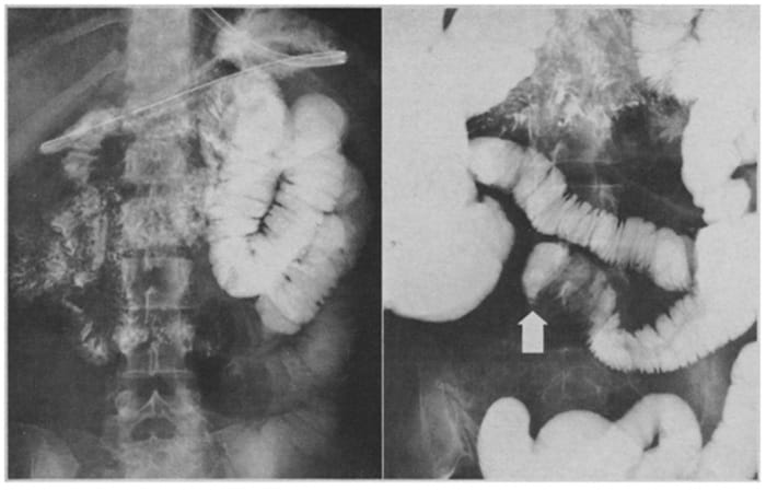Chụp X-quang nhanh chóng với chi phí thấp