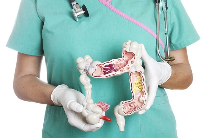 Có thể thực hiện khám đại tràng bằng các phương pháp khác