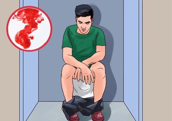 Bị rối loạn tiêu hóa nặng