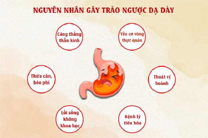 4 Nguyên nhân trào ngược dạ dày thường gặp