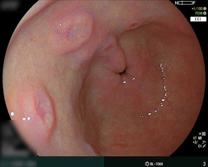 Với những trường hợp nội soi thông thường hình ảnh sẽ được trả ngay cho bệnh nhân