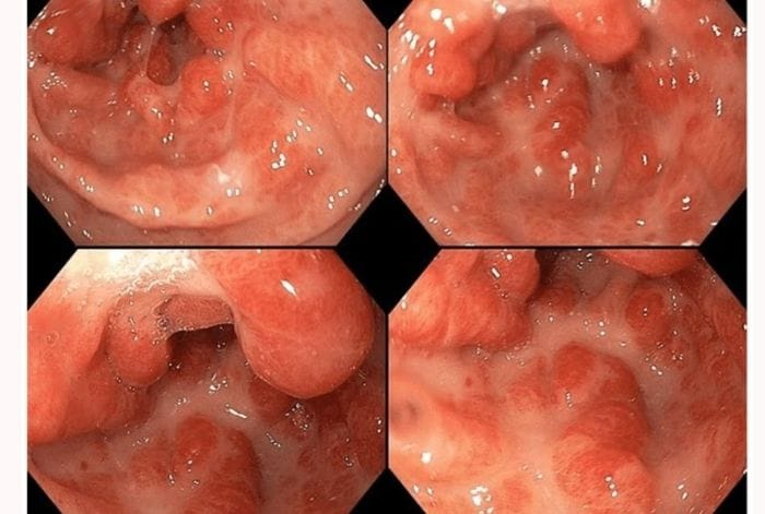 Phát hiện bệnh sớm