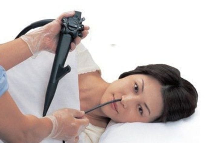 Nội soi qua đường mũi