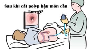Sau khi cắt polyp hậu môn, một số lưu ý quan trọng