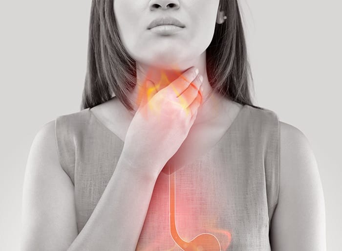 Trào ngược dạ dày thực quản có thể nguy hiểm nếu không điều trị kịp thời