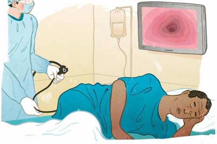 Cần thông báo với bác sĩ tình trạng bệnh lý trước nội soi