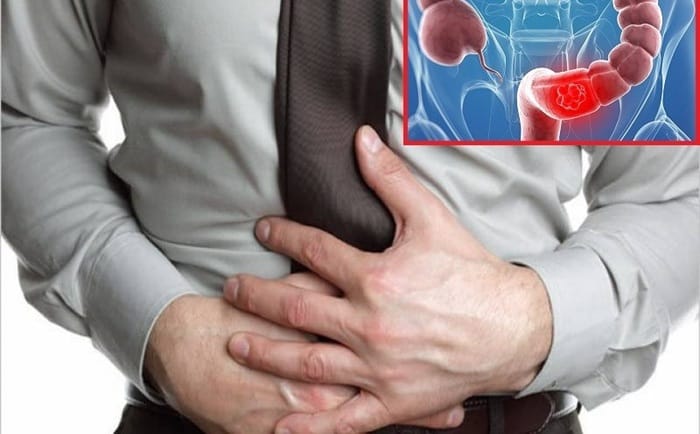 Nên đi thăm khám nếu đau bụng, sụt cân sau khi sử dụng