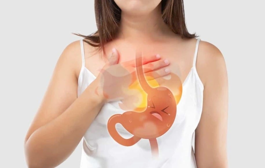 Trào ngược dạ dày gây đau họng chủ yếu do axit trào ngược