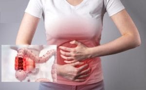 Viêm đại tràng có nguy hiểm không? Một số lưu ý quan trọng