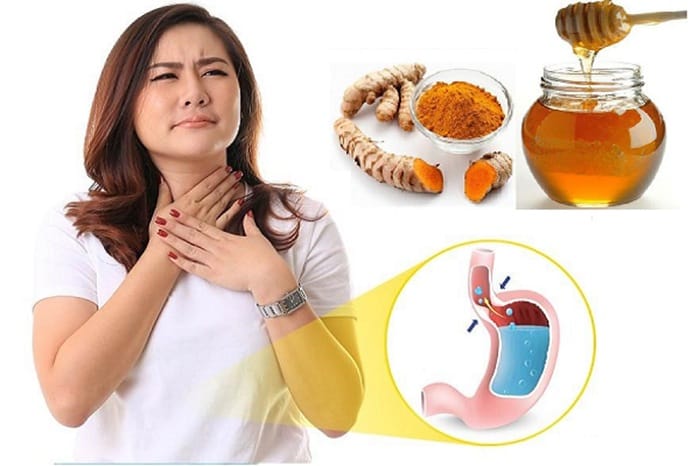Dùng mật ong để chữa trào ngược dạ dày tại nhà