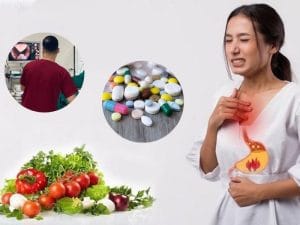 4 Phương pháp điều trị trào ngược dạ dày hiệu quả