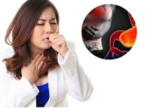 Ho do trào ngược dạ dày kéo dài bao lâu? Một số lưu ý