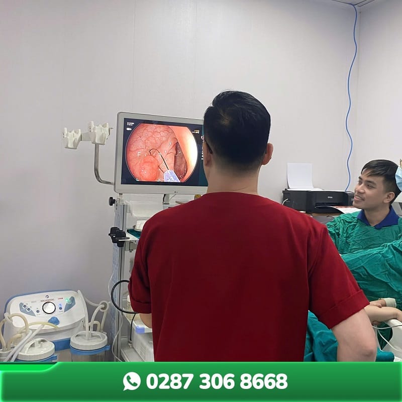 Ứng dụng nội soi đại tràng, dạ dày
