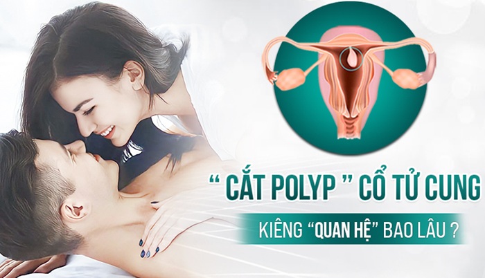 Cắt polyp tử cung kiêng quan hệ bao lâu, thời gian cần chú ý
