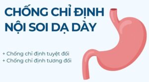Chống chỉ định nội soi dạ dày, các chiến chứng cần biết