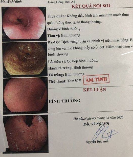 Kết quả nội soi dạ dày âm tính sau khi kiểm tra
