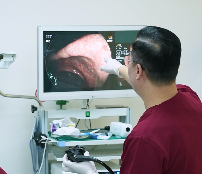 Bác sĩ chỉ định nội soi dạ dày cho người bệnh
