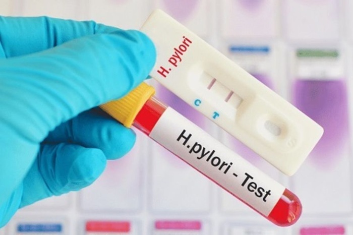 Không phải trường hợp nào cũng cần nội soi để test HP