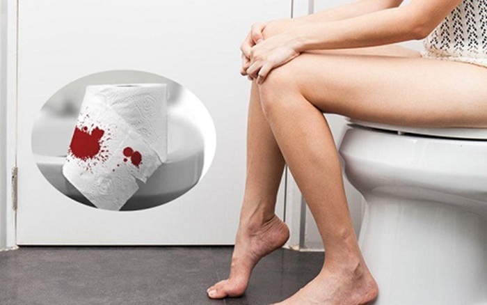 Tuyệt đối không dùng men vi sinh khi đang đi ngoài ra máu hoặc tiêu chảy