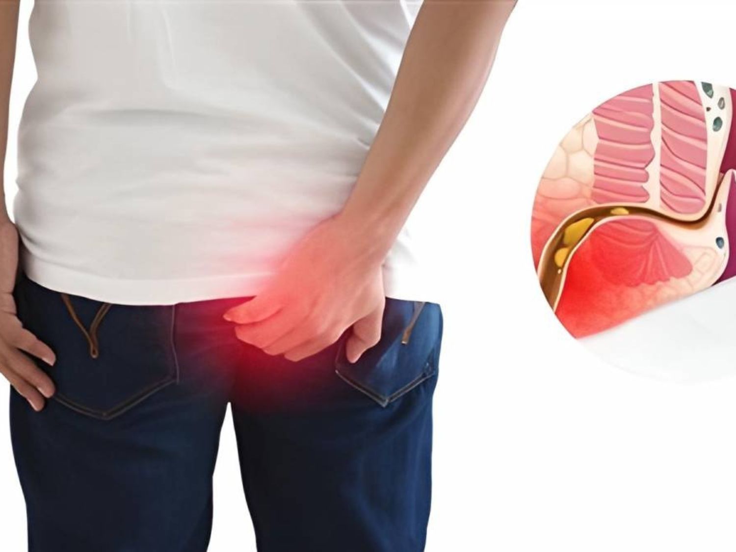 Khách hàng có triệu chứng đi vệ sinh ra máu