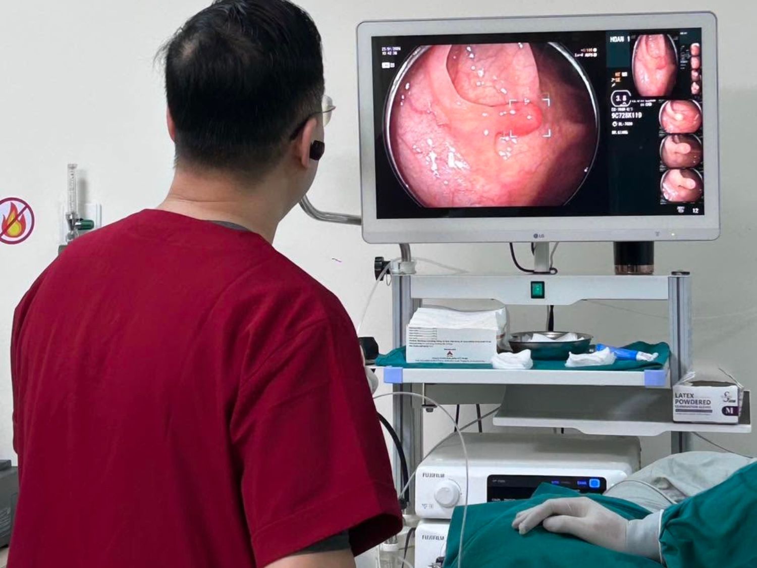 Quá trình nội soi diễn ra nhẹ nhàng, an toàn và cho kết quả chính xác