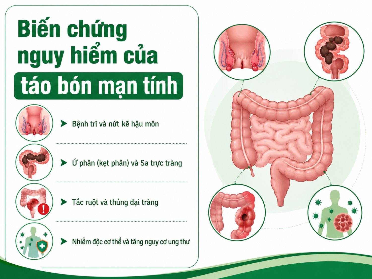 Không nên chủ quan với táo bón kéo dài vì tình trạng này có thể dẫn đến trĩ, nứt kẽ hậu môn, ứ phân, sa trực tràng, thậm chí tăng nguy cơ tắc ruột và biến chứng nghiêm trọng khác.