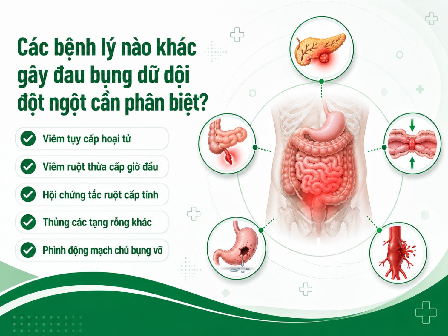 Đau bụng dữ dội đột ngột không chỉ gặp trong thủng dạ dày mà còn có thể liên quan đến nhiều bệnh lý cấp cứu khác. Người bệnh cần được thăm khám sớm để xác định nguyên nhân và tránh biến chứng nguy hiểm.