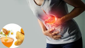 Chữa đau dạ dày tại nhà bằng cách nào an toàn? 7 cách làm dịu dạ dày cấp tốc
