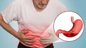 Đau bụng dữ dội đột ngột có phải thủng ổ loét dạ dày không?