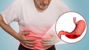 Đau dạ dày về đêm là bệnh gì? Có phải loét tá tràng không?