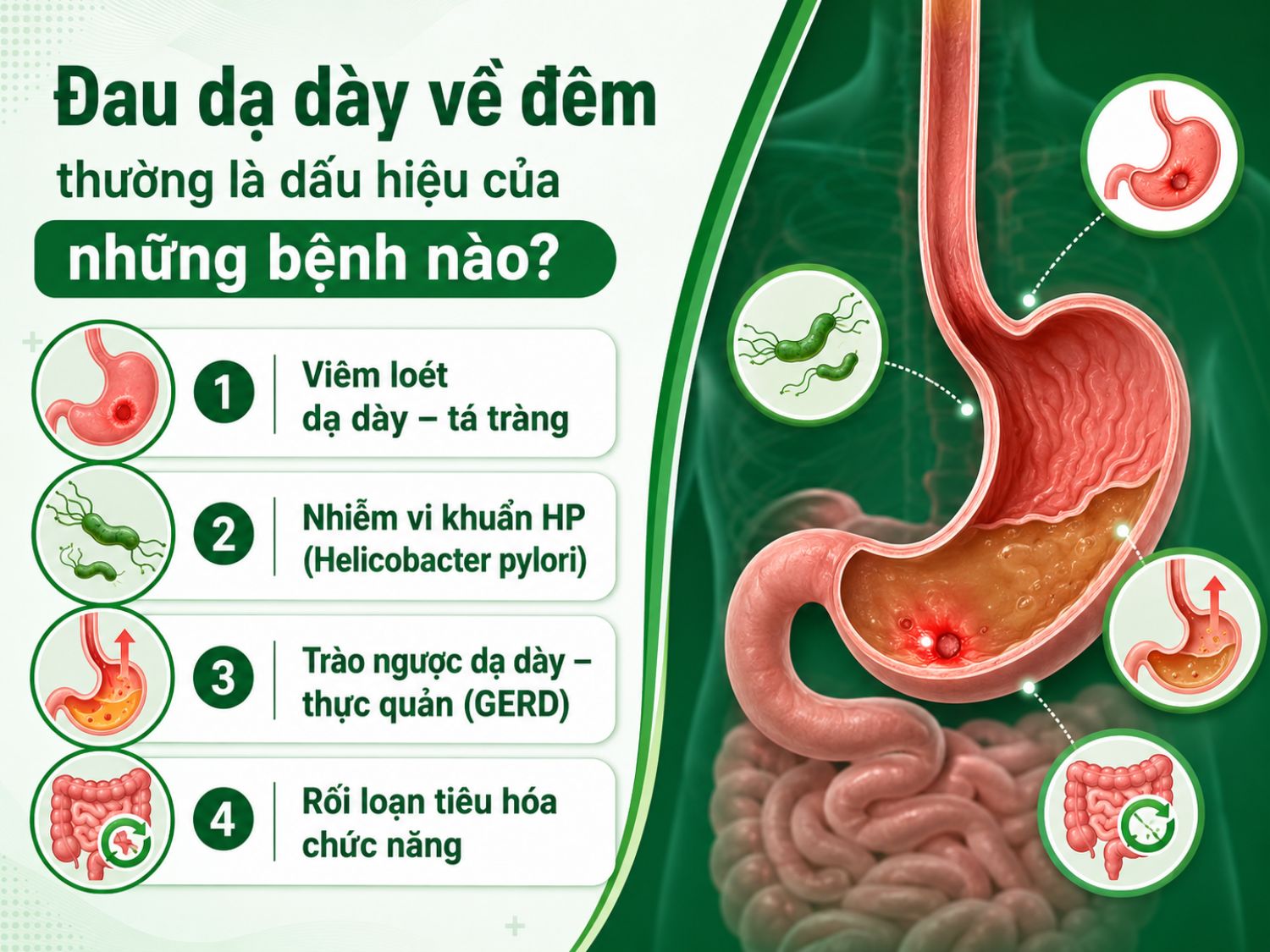 Đau dạ dày về đêm có thể liên quan đến viêm loét dạ dày tá tràng, nhiễm HP, trào ngược dạ dày thực quản hoặc rối loạn tiêu hóa chức năng. Nếu tình trạng lặp lại nhiều lần, người bệnh nên thăm khám để xác định nguyên nhân.