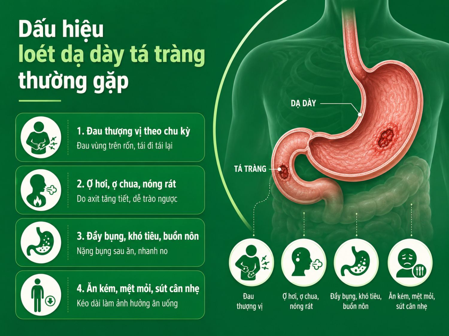 Loét dạ dày tá tràng có thể gây đau vùng thượng vị tái đi tái lại, kèm ợ chua, nóng rát, đầy bụng, buồn nôn hoặc ăn kém. Khi triệu chứng kéo dài, người bệnh nên thăm khám để được đánh giá chính xác.